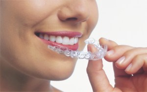 Woman with Invisalign